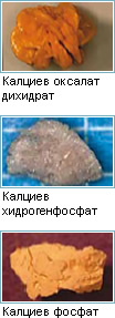 Калциеви камъни