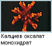 Оксалатни камъни в бъбреците