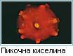 Уратни камъни